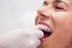 Invisalign Dentist in Whitefield: Your Path to a Straighter Smile